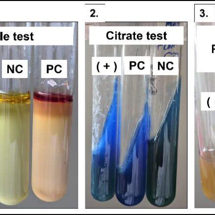 citrobacter diversus biochemical tests.